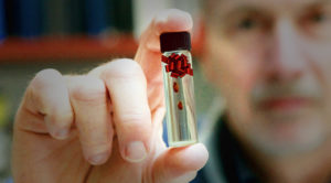 Texas A&M AgriLife Extension Service urban entomologist Dr. Mike Merchant shows a vial of adult bed bugs. (Texas A&M AgriLife Illustration by Gabe Saldana)